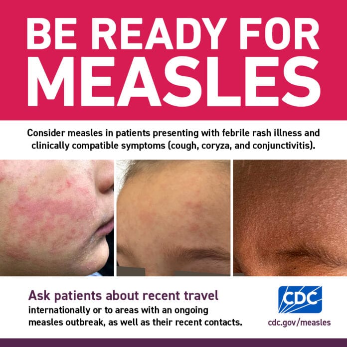 measeles be ready graphic